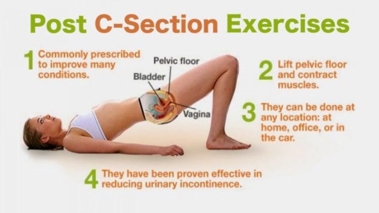 Physiotherapy (exercise) after cesarean section to strengthen abdomen and pelvis