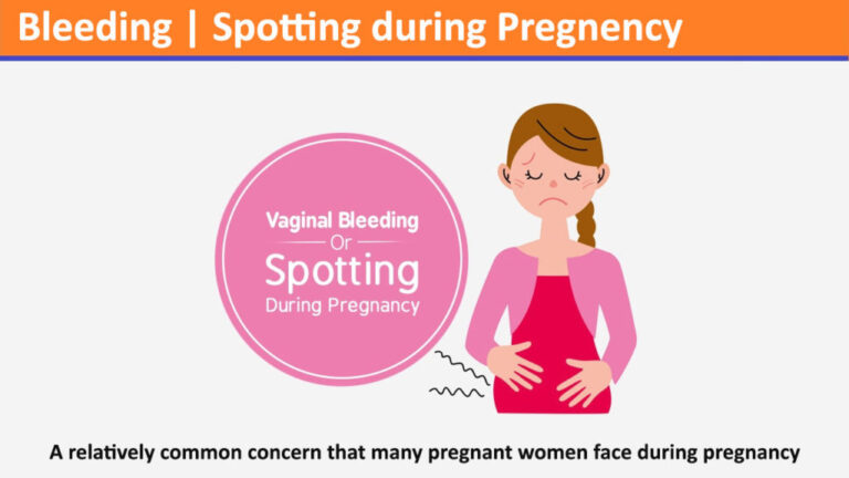 Spotting – a relatively common concern that many pregnant women face during pregnancy