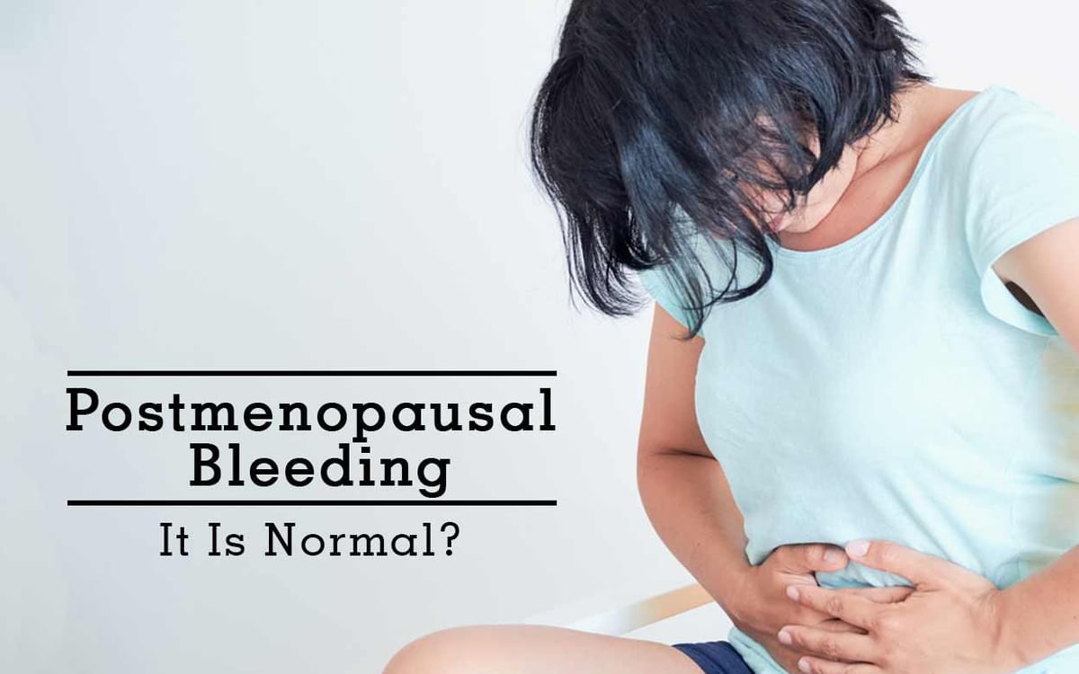 Postmenopausal Bleeding Causes, Symptoms, Diagnosis, and Treatment