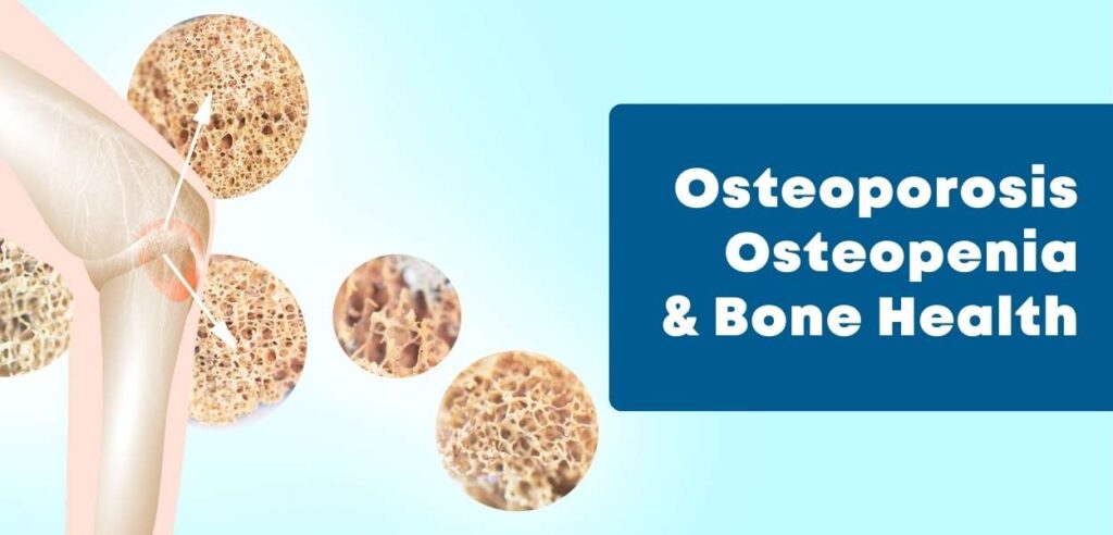 Osteoporosis and Bone Health: You Need to Know these things